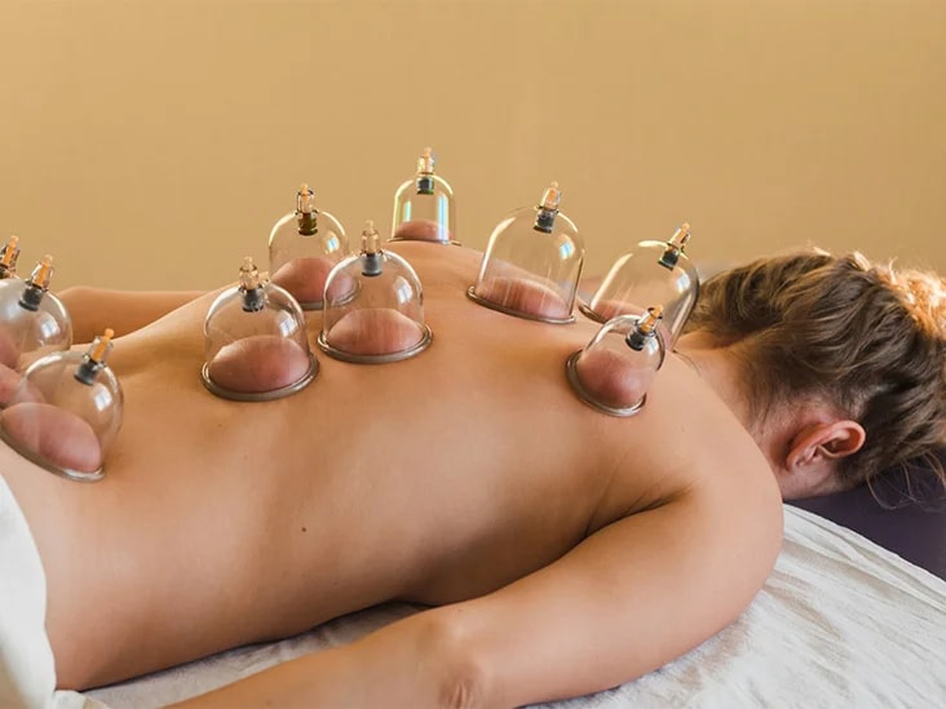 what are the benefits of cupping therapy how can it help you