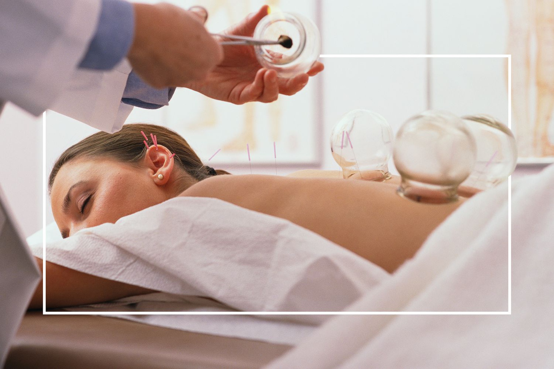 can you take a shower after cupping therapy?avoid doing this