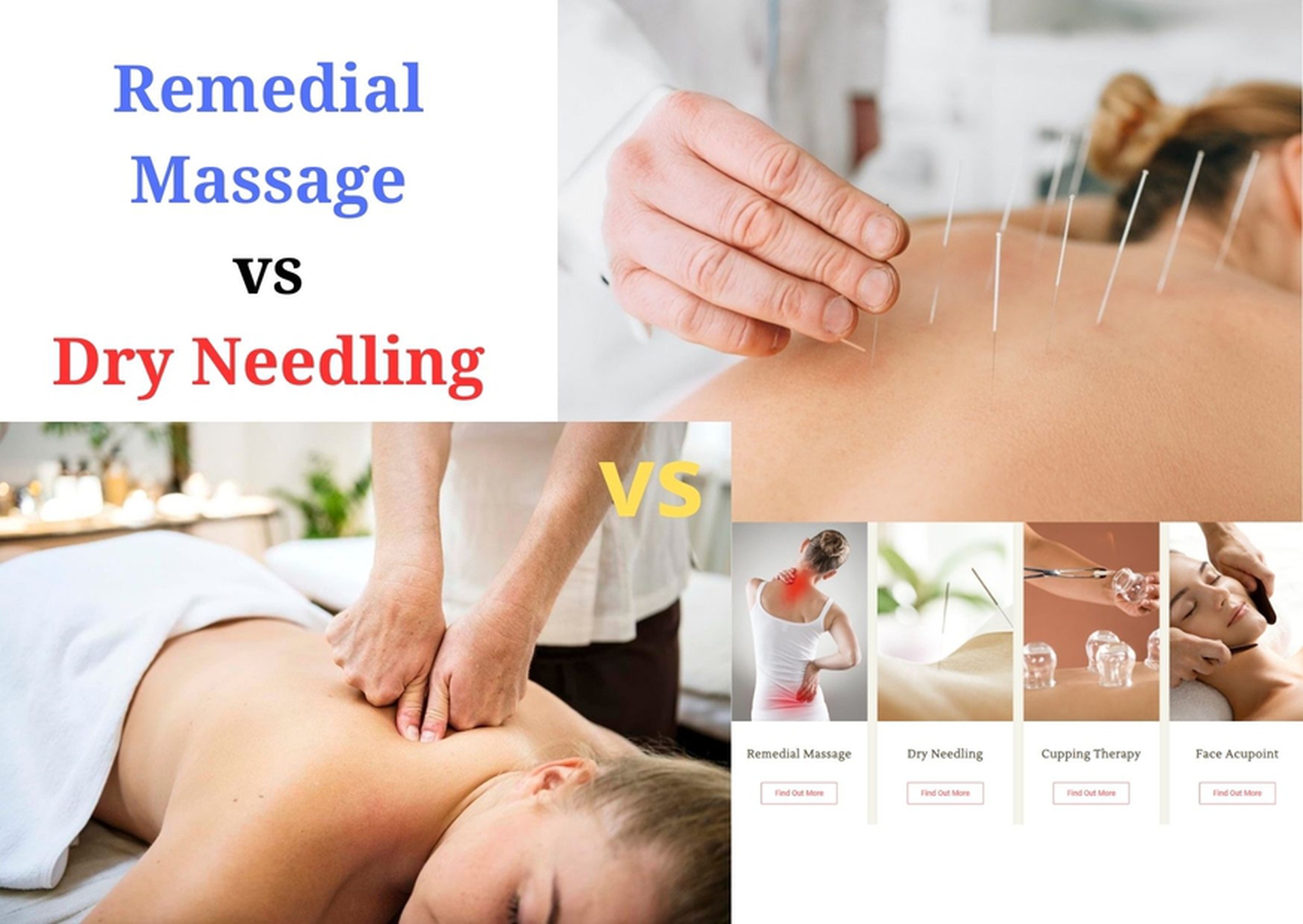 remedial massage and dry needling the perfect pair