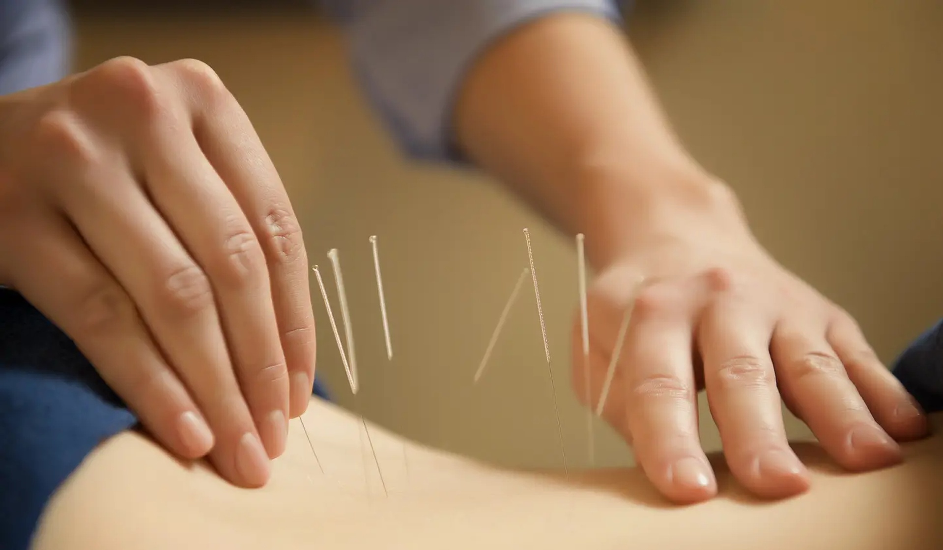 will dry needling help lower back pain the right answer