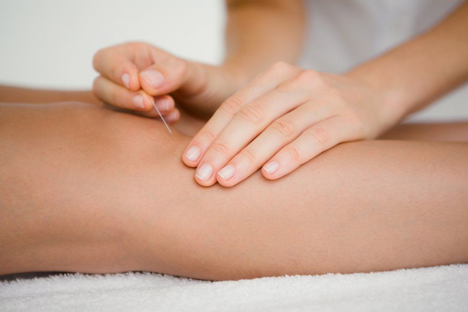 how long does dry needling last reveal duration