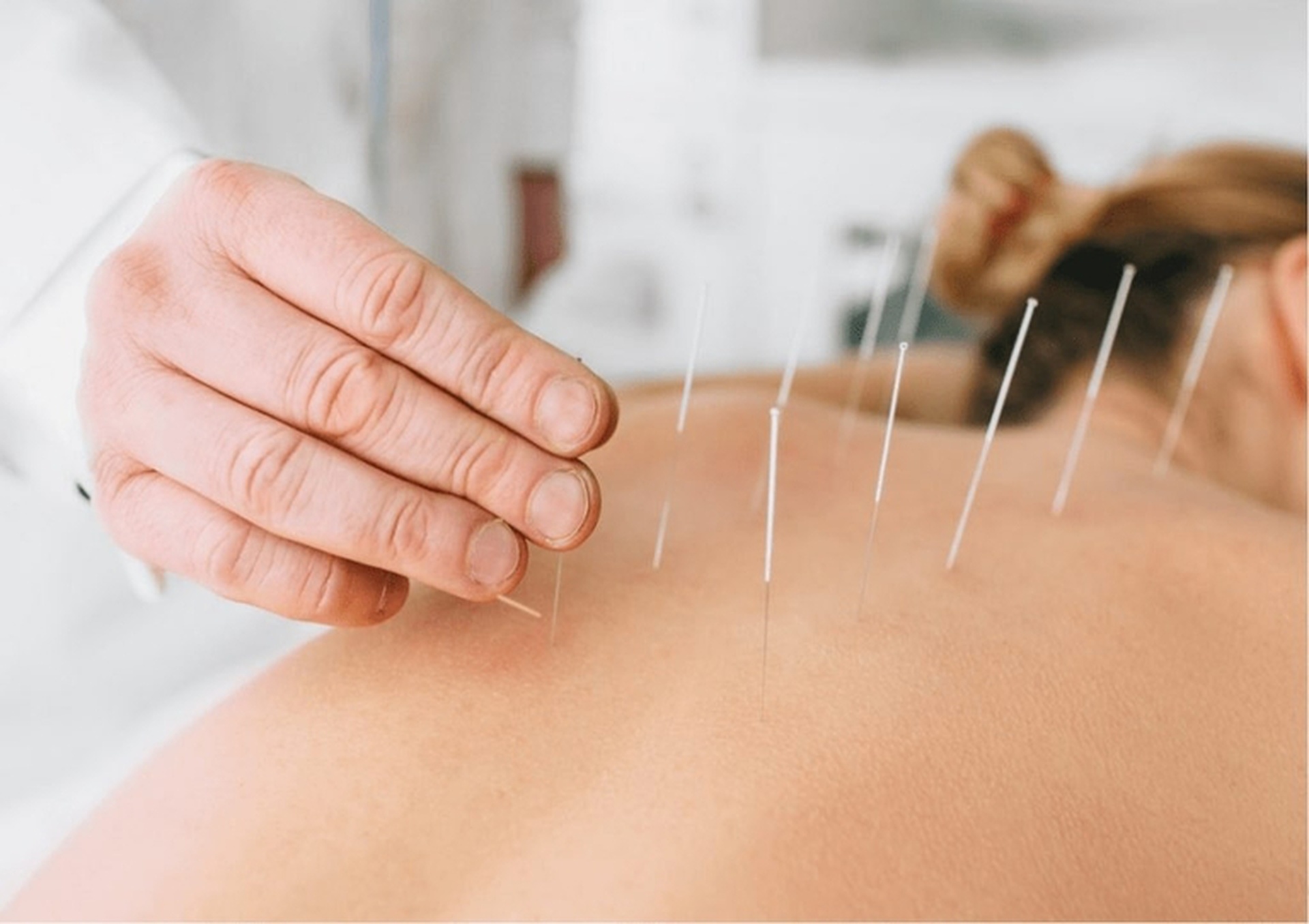 pros and cons of dry needling why you should know